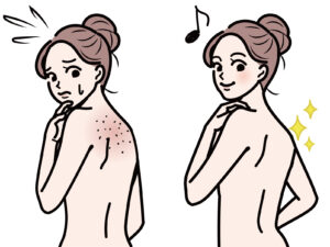 症状に合った背中のにきびの対策