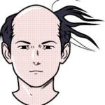 育毛のために改善したい生活習慣