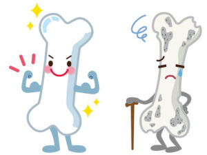 更年期に骨を強くする